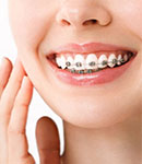 ارتودنسی دندان چیست و چرا انجام می‌شود؟ کلینیک خیریه حضرت زهرا کن