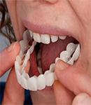 انواع روکش و پروتز دندان