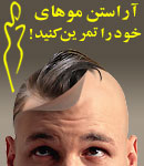 کلینیک ایرانیان - کاشت مو