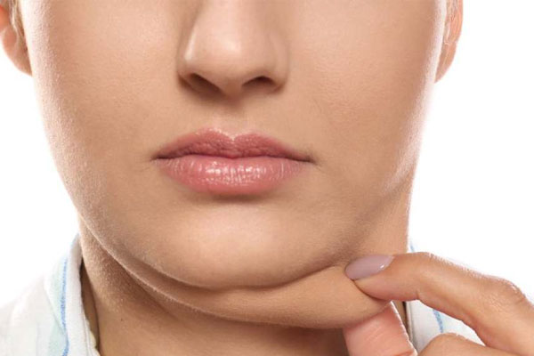 ماندگاری نتایج از بین بردن غبغب با لیزر