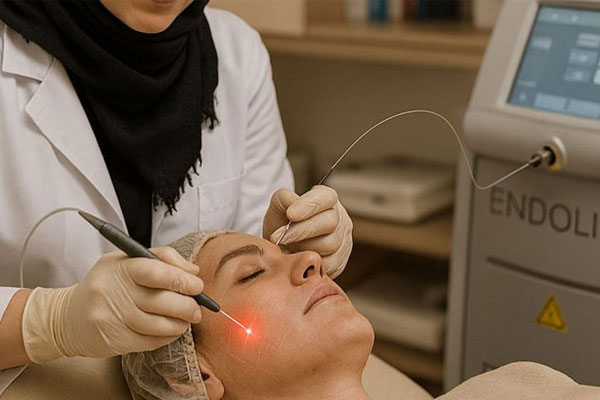 کدام نواحی را میتوان اندولیفت کرد؟