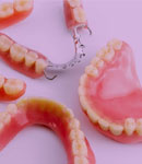 انواع پروتزهای ثابت و متحرک دندان، راهنمای کامل برای انتخاب بهترین گزینه در دندانپزشکی حکیمان