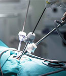 جراحی لاپاراسکوپی توسط دکتر محمد گنجه روشی کم تهاجمی برای درمان بیماری ‌ها