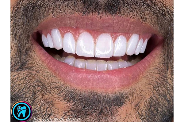 دندانپزشکی خوب در اشرفی اصفهانی