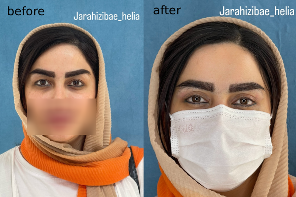 سه کلید طلایی برای خلق «خواب طبیعی» و بی‌نقص (راز کار حرفه‌ای‌ها)