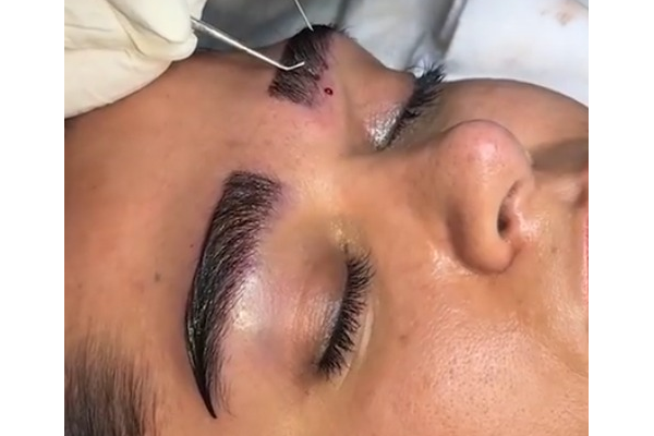 جهت دهی دقیق در کاشت ابرو