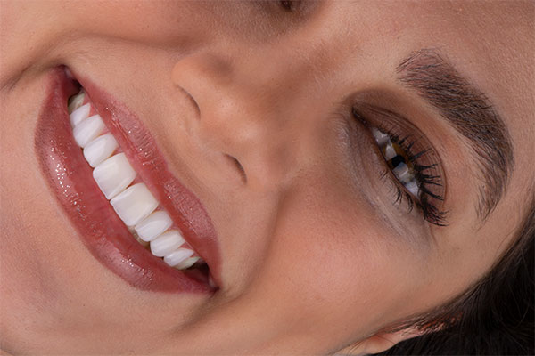 مزایای لبخند دیجیتیال