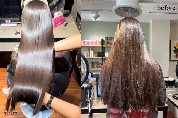 روش های احیا مو در لیمانو