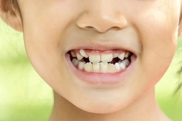 چه زمانی برای انجام ارتودنسی مناسب تست