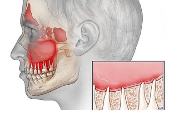 مشکلات مفصل فک (TMJ)