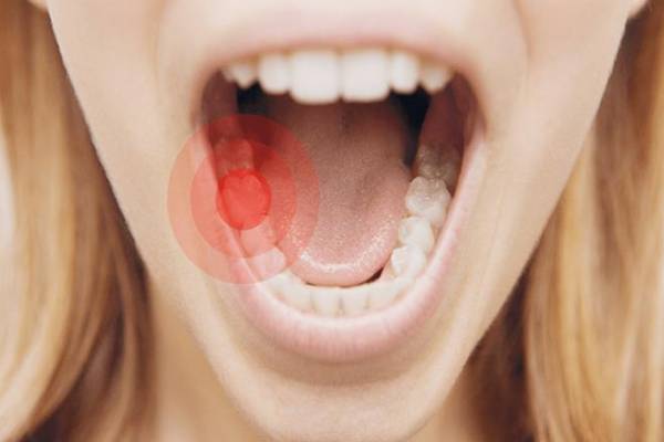 علت دندان درد یهویی