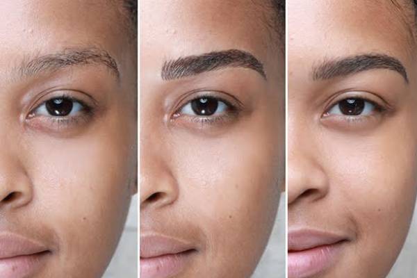 ترمیم فیبروز و میکروبلیدینگ به چه صورت است؟