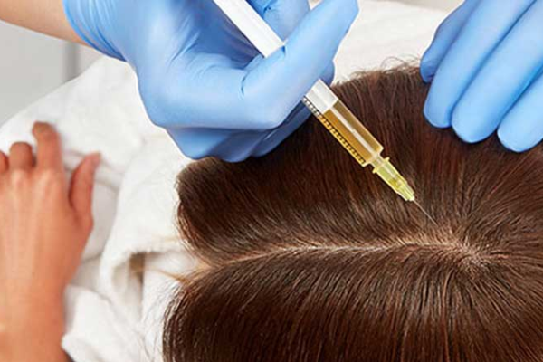 انجام ترکیببی فوتوتراپی و پی آر پی اگروزوم توسط دکتر مهدی ابراهیمی