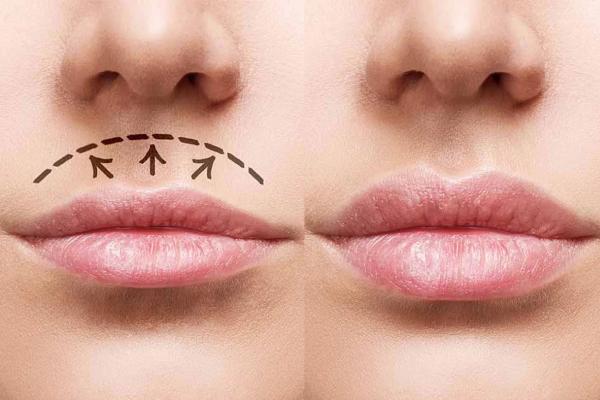 مزایای سانترال لب چیست؟