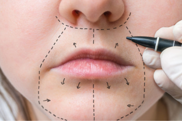 روش های انجام جراحی سانترال لب