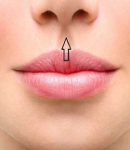 جراحی سانترال لب، روش‌ها، مزایا و نکات مهم بعد از عمل