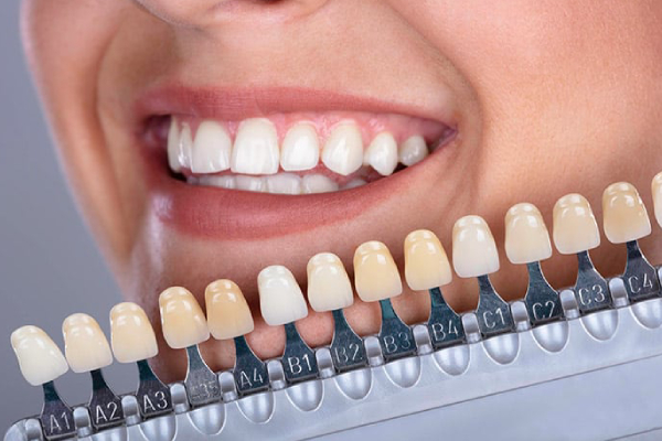 لمینیت چیست