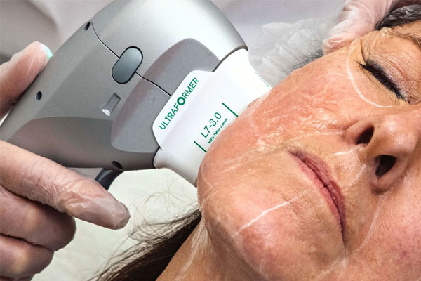 مزایای هایفوتراپی صورت