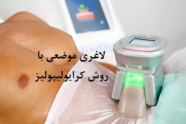 مزایای استفاده از دستگاه کرایو