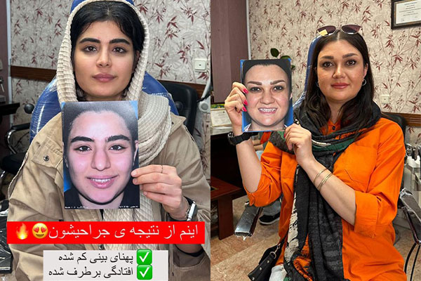 جراحی بینی گوشتی