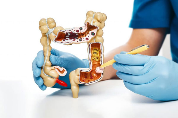 آیا سرطان روده با آزمایش خون قابل تشخیص است