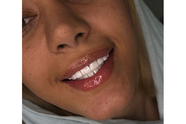 کامپوزیت دندان در تهرانپارس