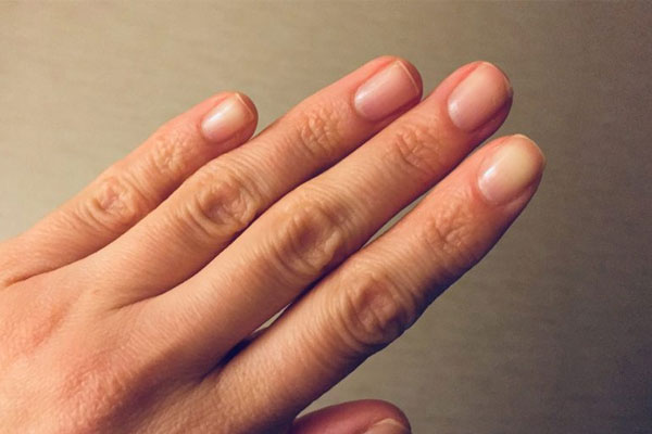  رشد سریع ناخن در سه روز