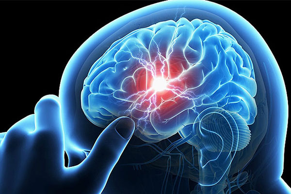 درمان قطعی آنوریسم مغزی