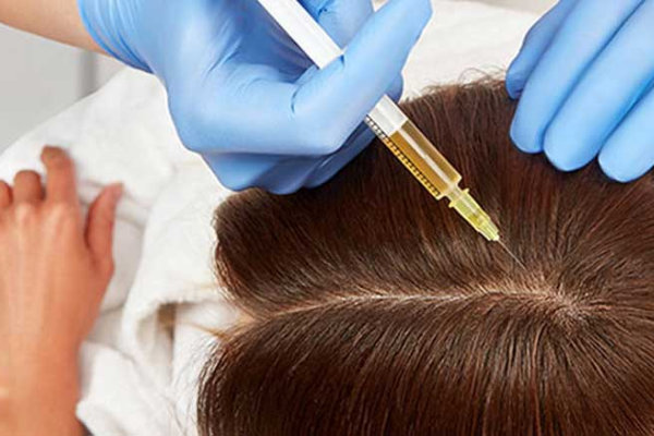 مراقبتهای قبل و بعد از PRP مو