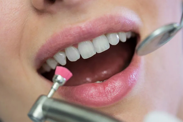 مراحل انجام بروساژ دندان