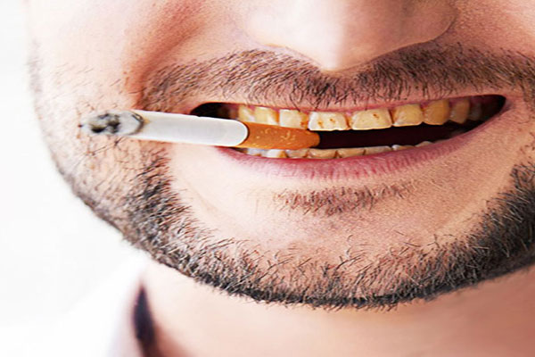 چرا سیگار باعث سیاهی لثه میشود؟