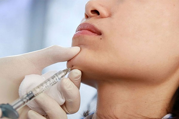 مراحل انجام صاف کردن چانه سنگ فرشی