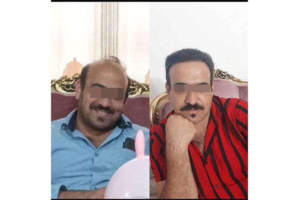  مراقبت های بعد از کاشت مو