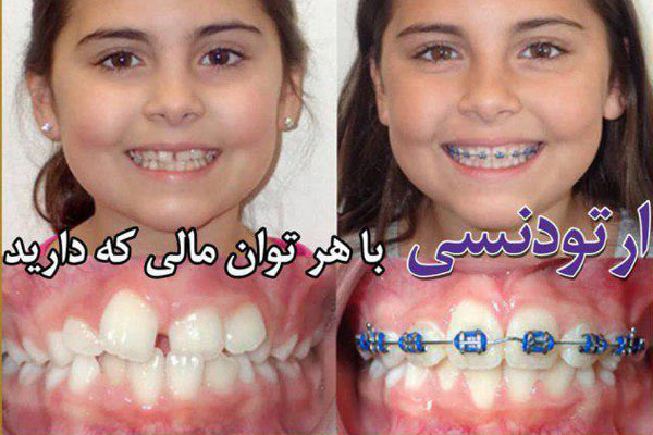 دکتر خوب برای ارتودنسی در کرج