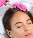 مزایا و نکات مراقبتی بعد از انجام هیر فیلر