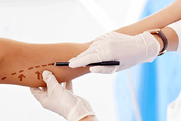 روش جراحی لیفت بازو(براکیوپلاستی)