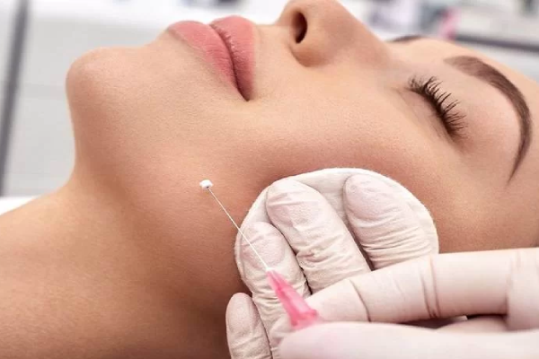 لیفت صورت با نخ برای چه کسانی مناسب است؟