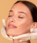 آشنایی با انواع نخ‌های مورد استفاده در لیفت صورت