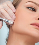 فیلر صورت، تکنیکی مدرن برای جوانسازی و لیفت فوری پوست