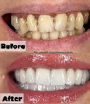 آمادگی برای ویزیت دندانپزشک، نکاتی که هر بیمار باید رعایت کند