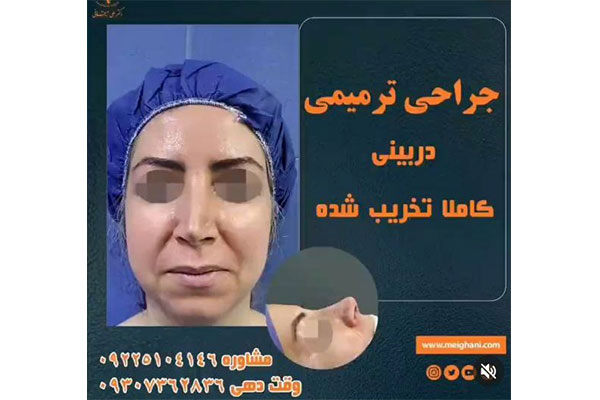بهترین جراح ترمیمی در ونک