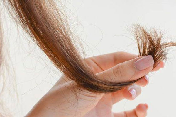 درمان خانگی مو خوره