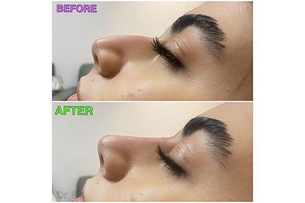 نکات مهم برای انتخاب متخصص تزریق ژل