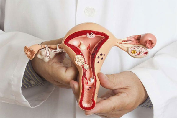 راه های درمان فیستول واژن 