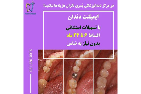 مرکز دندانپزشکی و ایمپلنت یسری