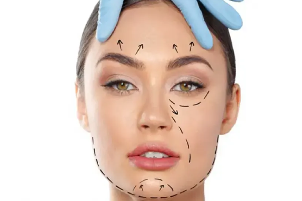 مزایای لیفت صورت با نخ