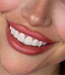 طراحی لبخند با لمینت سرامیکی توسط دکتر نازنین نوربخش