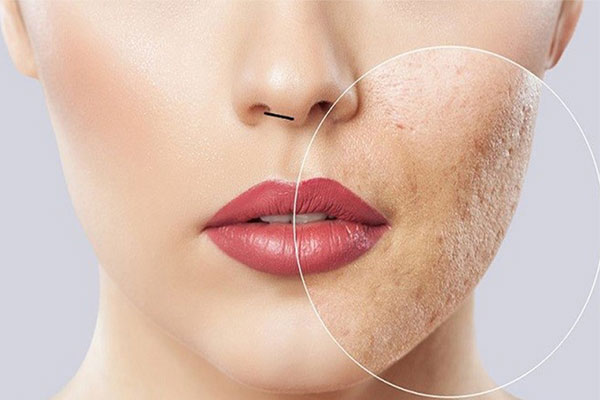 بهترین کلینییک برای مزوتراپی در پاسداران