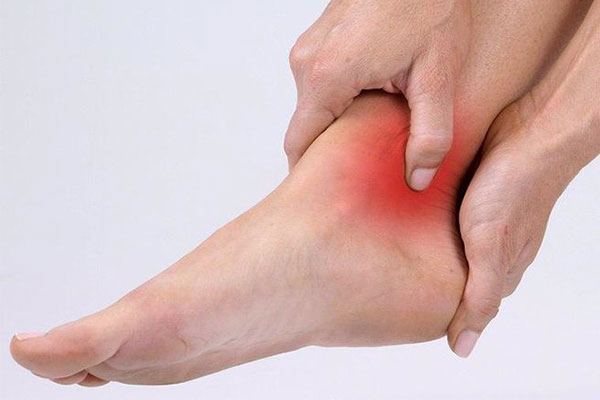 درمان پیچ خوردگی مچ پا