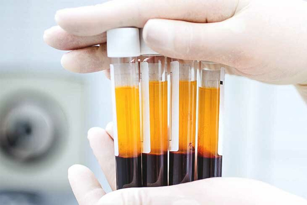 عوارض جانبی پی ار پی مو 